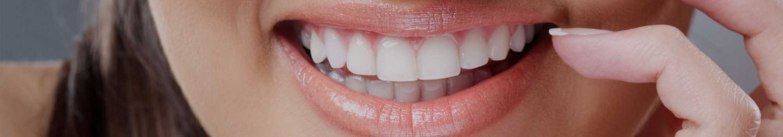 Teeth Straightening Dingwall