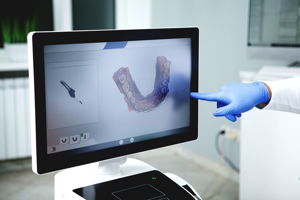 Invisalign 101 – Most Common Questions Answered