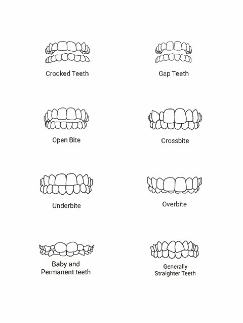 Invisalign 101 - Most Common Questions Answered