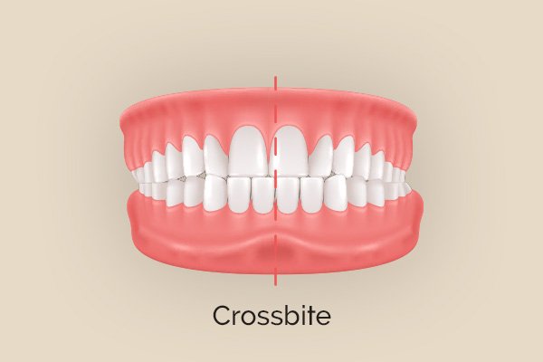 Best Invisalign provider in Highlands